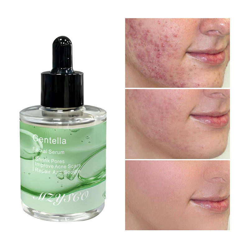 Wholesale 50ml Private Label Face Skin Care Shrink Pores Repair Soothe Centella Facial Serum