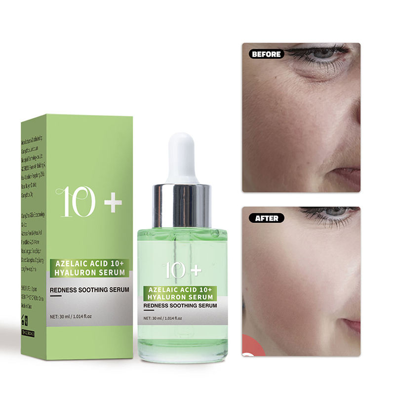 Wholesale 30ml Face Skin Care Moisturizing Soothing Azelaic Acid 10+ Hyaluronic Serum