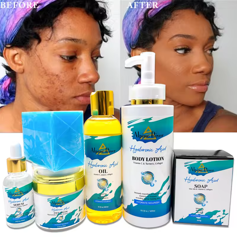 Natural Organic Vitamin C Skin Whitening Beauty Products Blue Nila Whitening Korean Cosmetics Skin Care Set